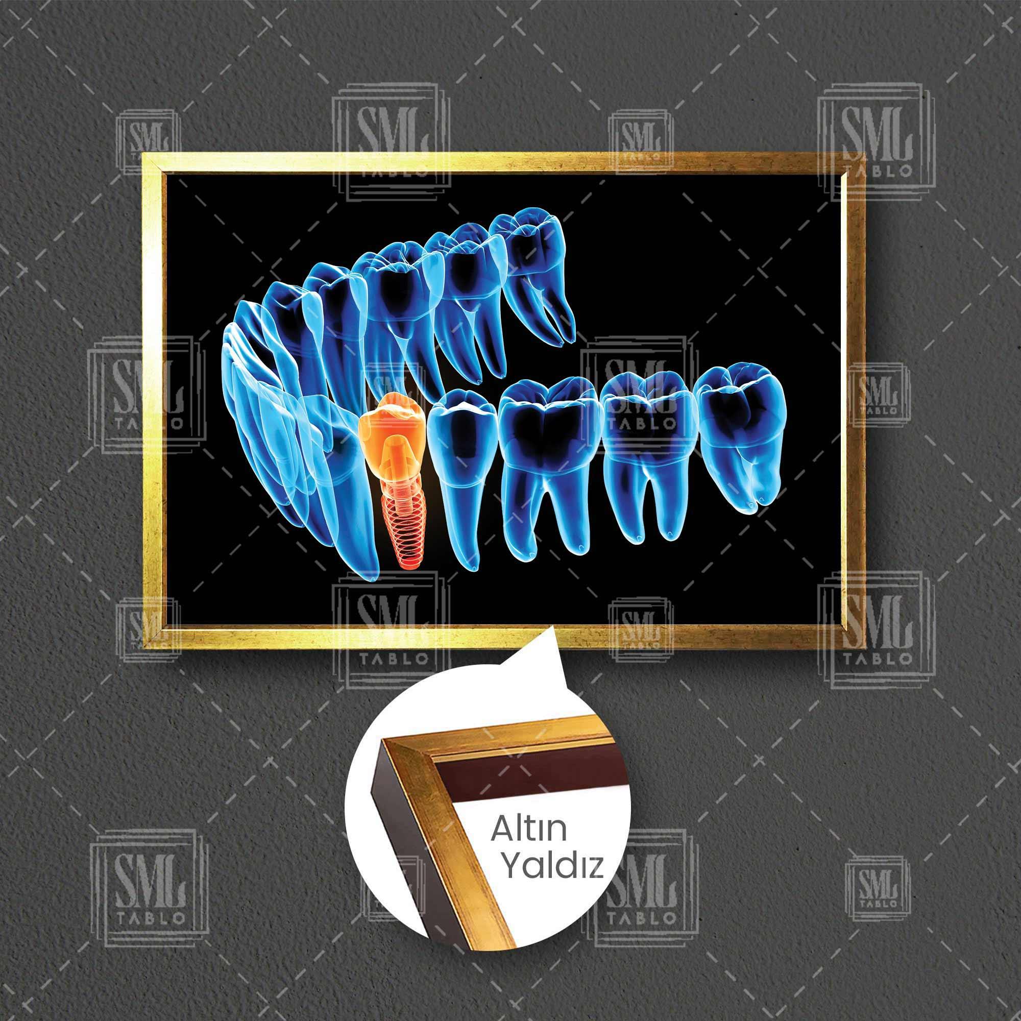 Dişçi Diş Hekimi Ofisi Gülüş Tasarımı Dentist Çerçeveli Yatay Kanvas Tablo Dişçi Diş Hekimi Ofisi Gülüş Tasarımı Dentist Çerçeveli Yatay Kanvas Tablo