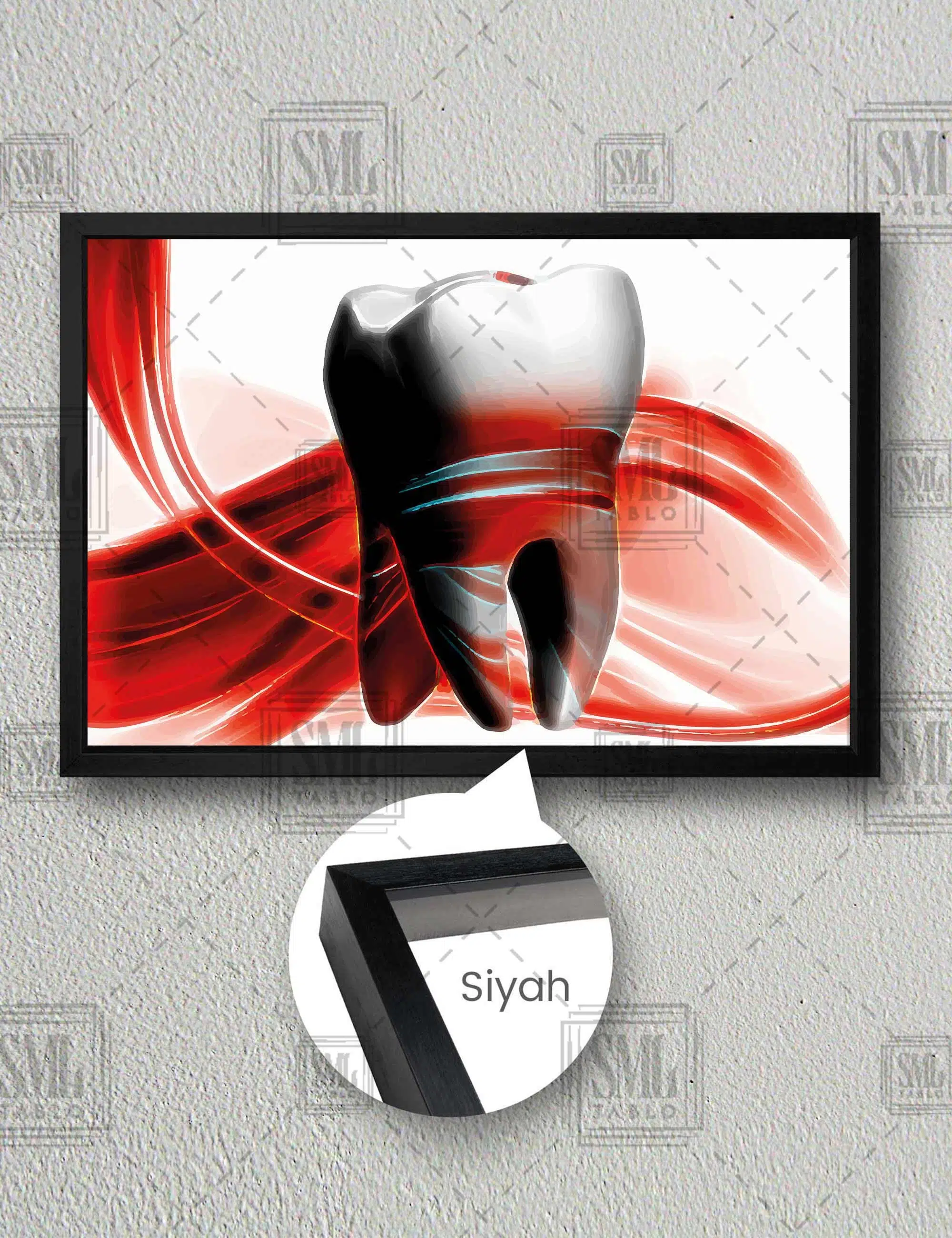 Ağız Sağlığı Diş Hekimi Büro Dental Art Dekoratif Yatay Çerçeveli Kanvas Tablo - Siyah