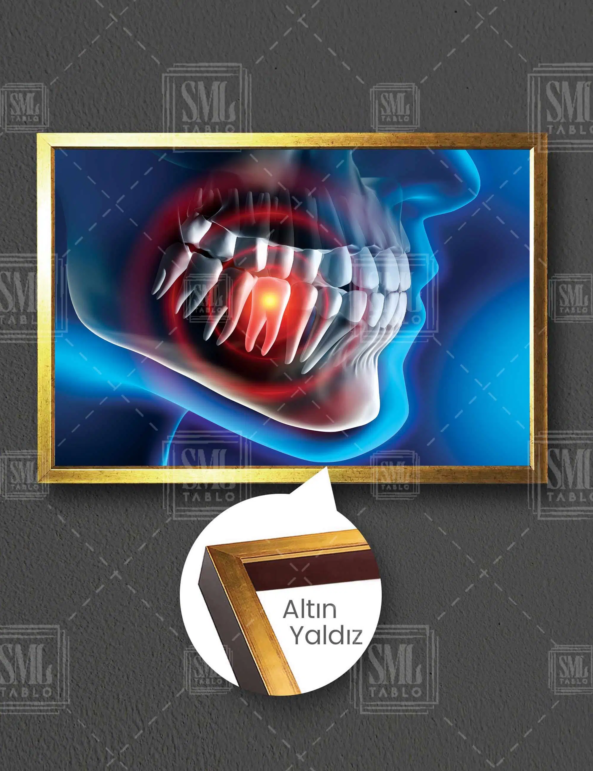 Ağız Ve Diş Sağlığı Dişçi Diş Hekimi Ofisi Dentist Yatay Çerçeveli Kanvas Tablo