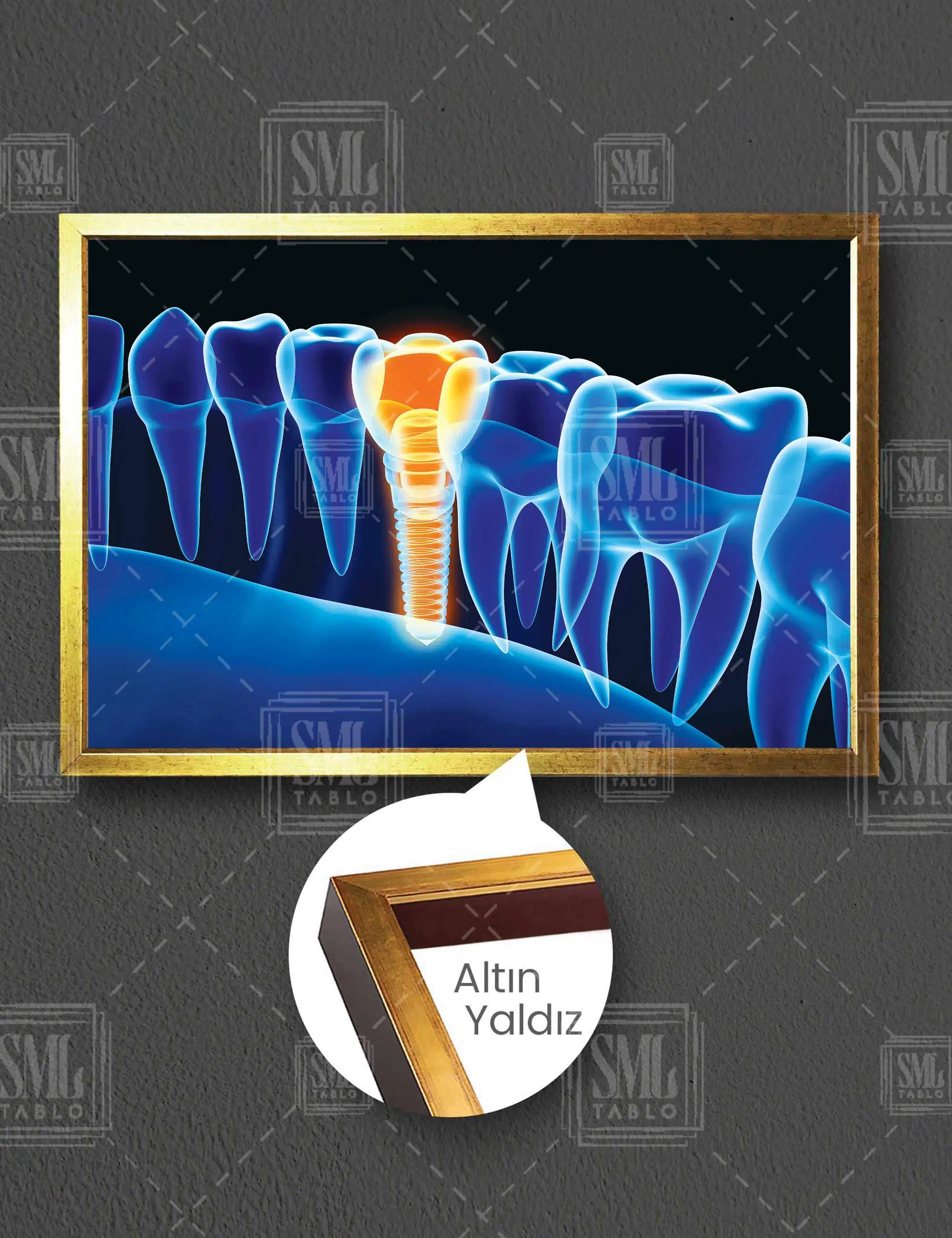 Dişçi Diş Hekimi Ofisi Ağız Ve Diş Sağlığı Dentist Yatay Çerçeveli Kanvas Tablo