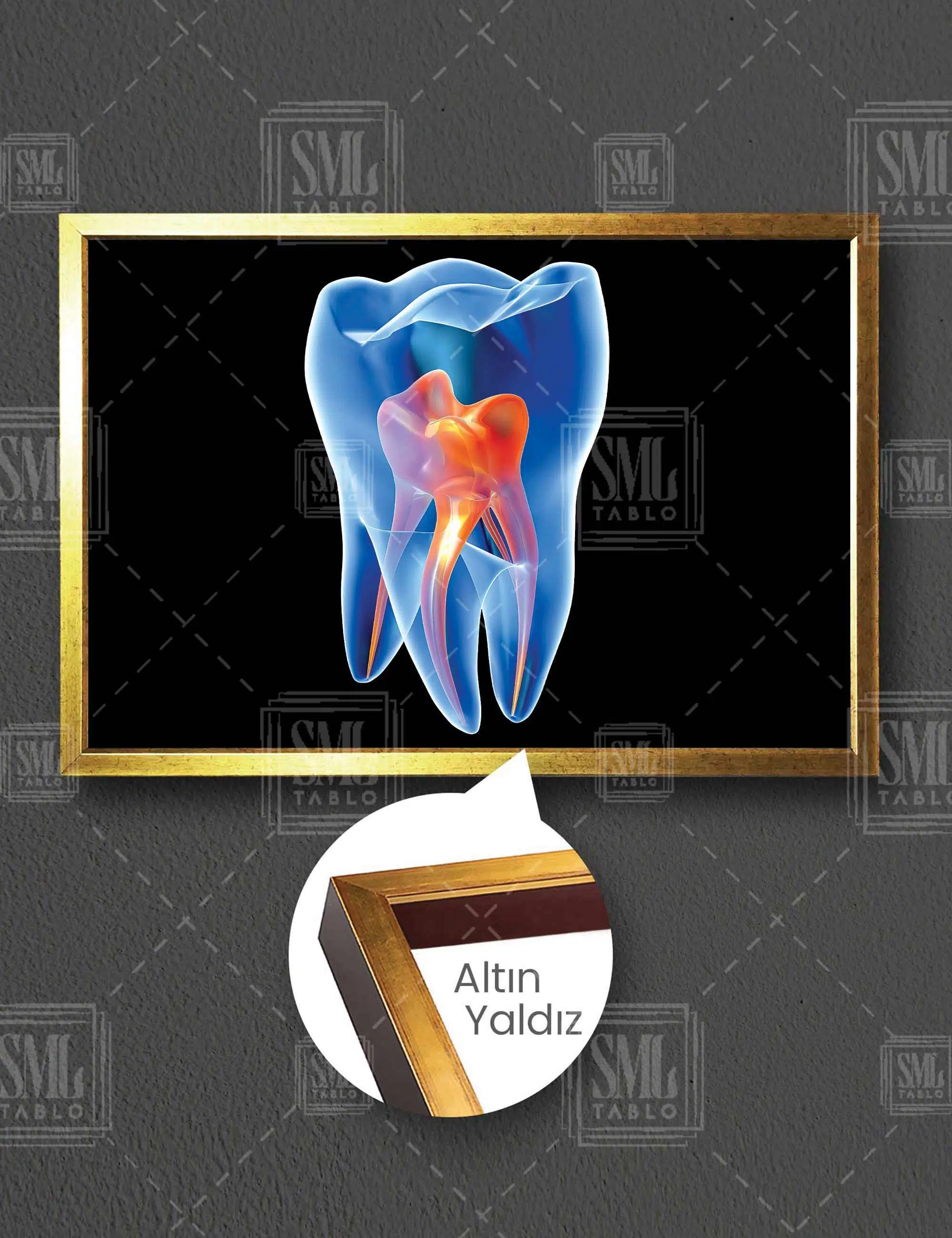 Diş Hekimi Ofisi Kanal Sinirler Dişçi Dentist Yatay Çerçeveli Kanvas Tablo